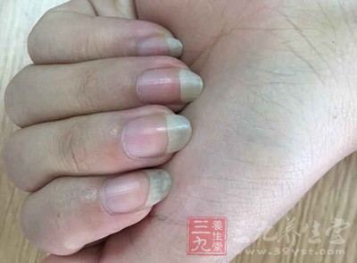 通常是胃酸分泌不足所導(dǎo)致