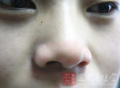 近2年屈光度穩(wěn)定，其發(fā)展速度每年不大于0.50D